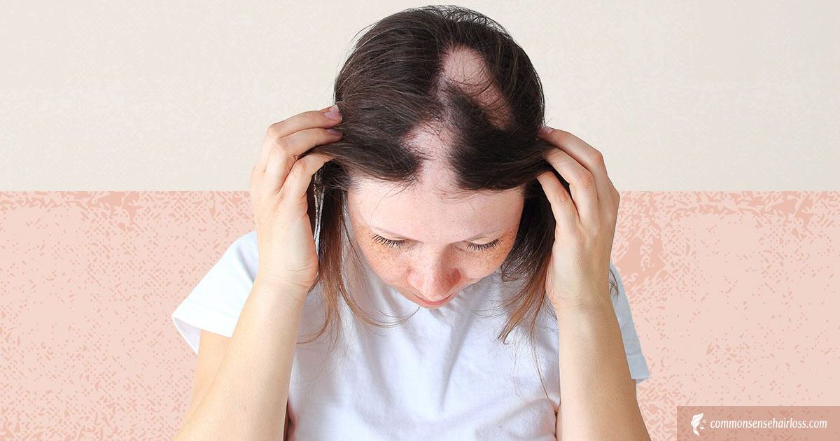 Causes of Abnormal Hair Loss in Children