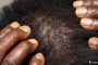 What To Do When You See These Early Signs Of Hair Loss